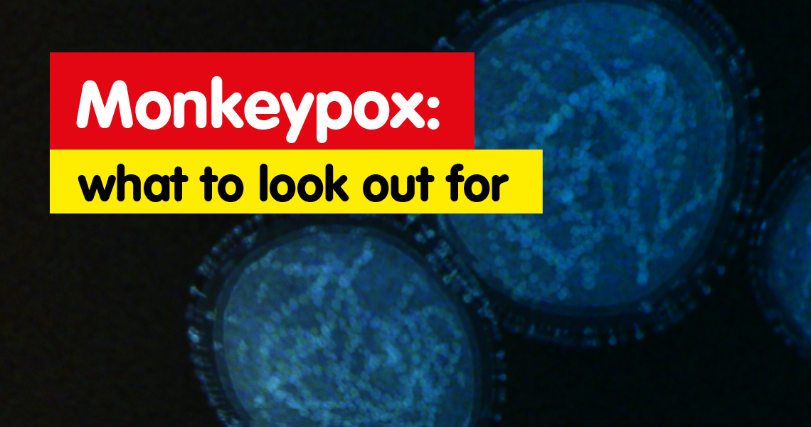 Rare cases of Monkeypox diagnosed in the UK